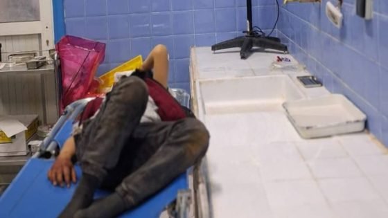 إصابة 16 شخصًا جراء انقلاب سيارة قرب أزيلال