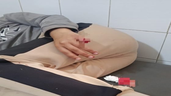 بتر إصبع طفل بسطات يفضح أزمة الفضاءات الترفيهية ويجدد المطالبة بمسابح عمومية